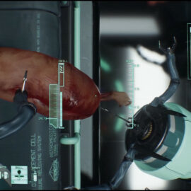 MALPRAXIS je kirurški horor iz prvog lica